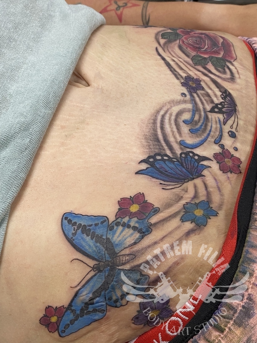 Bloemen en vlinders over litteken Tattoeages