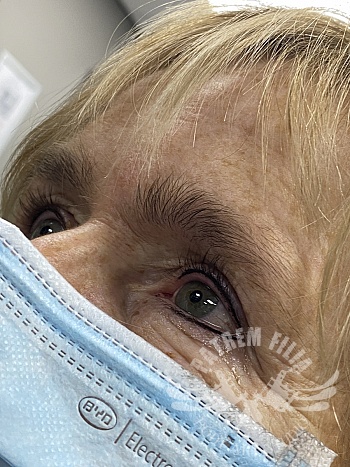 Deep liner boven en onder