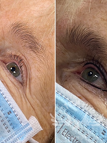 Fijne eyeliner boven en onder, voor en na 
