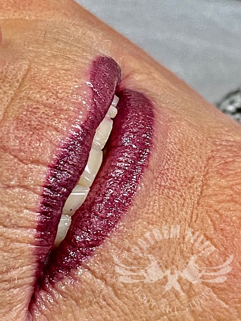 Full lips