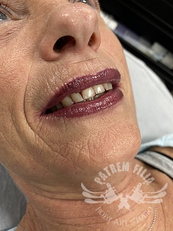 Full Lips