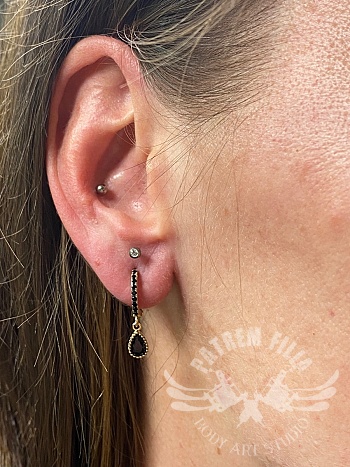 Conch en upper lobe