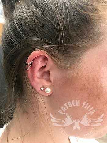 double helix