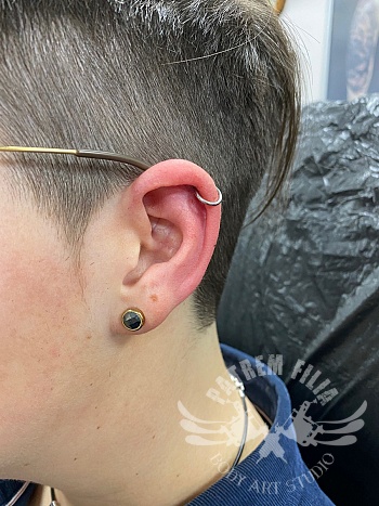 Helix