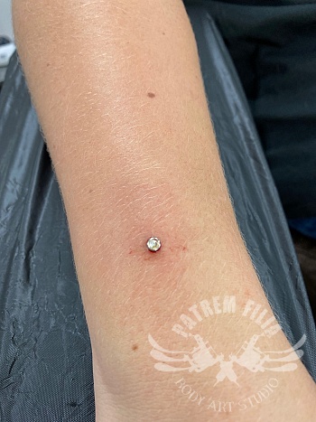 Micro Dermal op pols
