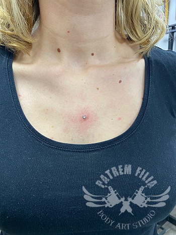 Microdermal borst