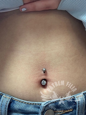 Navel