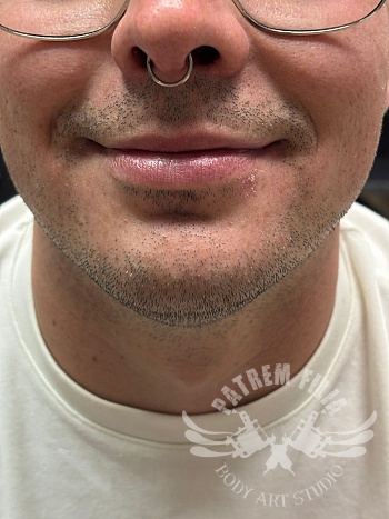 septum