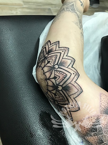 Elleboog Mandala