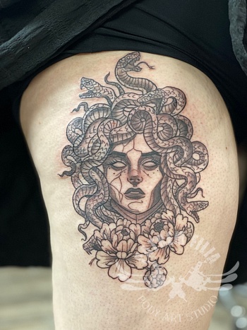 Medusa op bovenbeen