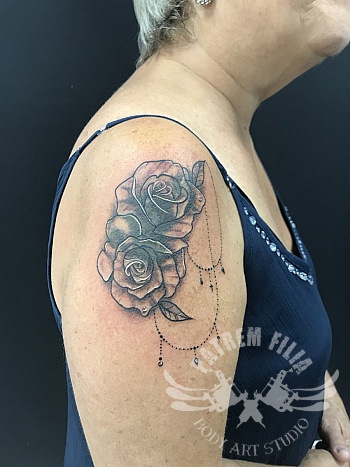 rozen cover-up
